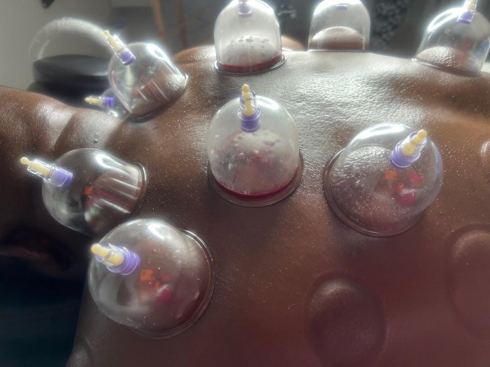 My hijama